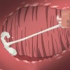 Thumbnail of related posts 037